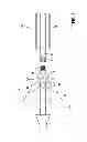 Fig. 02 - Implant, system formed of an implant and a catheter, and method for producing such a system