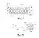 Fig. 06 - Stents with attached looped ends