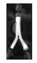 Fig. 01 - ARTERIAL IMPLANTS