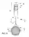 Fig. 06 - ENDOLUMINAL PROSTHESIS