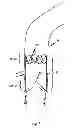 Fig. 02 - Device for the implantation and fixation of prosthetic valves