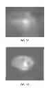Fig. 06 - Method for designing, evaluating and optimizing ophthalmic lenses and laser vision correction