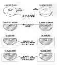 Fig. 01 - Method of manufacturing breast implants with integrated transponders