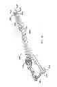 Fig. 12 - Expandable vertebral prosthesis