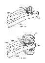 Fig. 13 - Expandable vertebral prosthesis