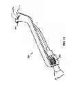 Fig. 16 - Expandable vertebral prosthesis