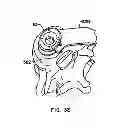 Fig. 17 - Expandable vertebral prosthesis