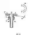 Fig. 20 - Expandable vertebral prosthesis