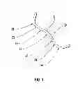 Fig. 02 - PROSTHETIC JOINT WITH ALIGNMENT FEATURE