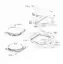 Fig. 28 - PROSTHETIC JOINT WITH ALIGNMENT FEATURE
