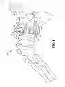 Fig. 02 - Spring base glenosphere