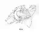 Fig. 06 - Spring base glenosphere