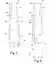 Fig. 06 - Knee prosthesis system with standard and distal offset joint line