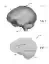 Fig. 04 - Model-based helmet design to reduce concussions