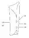 Fig. 01 - Self-securing forearm guard