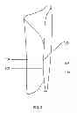 Fig. 03 - Self-securing forearm guard