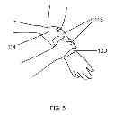 Fig. 06 - Self-securing forearm guard
