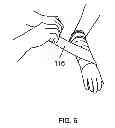 Fig. 07 - Self-securing forearm guard