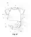 Fig. 09 - INFANT BODYSUIT