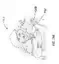 Fig. 95 - Apparel systems, wearable item systems, decor systems, and other systems and designs