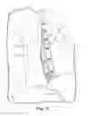 Fig. 06 - PATIENT GOWN