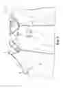 Fig. 08 - PATIENT GOWN