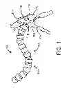 Fig. 02 - ARTICULATING RESTRAINT DEVICE