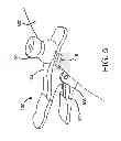 Fig. 06 - ARTICULATING RESTRAINT DEVICE