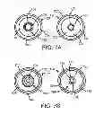 Fig. 08 - ARTICULATING RESTRAINT DEVICE