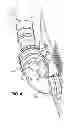 Fig. 04 - Clothes dryer exhaust device