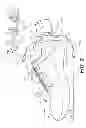 Fig. 03 - Footwear having removable motorized adjustment system