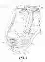 Fig. 04 - Footwear having removable motorized adjustment system