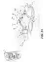 Fig. 26 - Footwear having removable motorized adjustment system