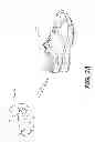 Fig. 31 - Footwear having removable motorized adjustment system