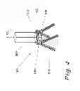 Fig. 06 - Anchoring system with post angular adjustment