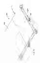 Fig. 02 - SUPPORT PEDESTAL ASSEMBLY INCLUDING A STABILIZING COLLAR FOR STABILIZING A SUPPORT STRUCTURE