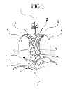 Fig. 06 - Corn Stalk Harvester