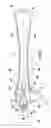 Fig. 04 - Ejector with motive flow swirl