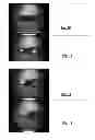 Fig. 08 - SAMPLE NEBULIZATION