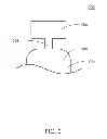 Fig. 03 - Volumetric measurement device, system and method