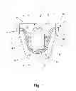Fig. 02 - Coriolis mass flowmeter