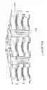 Fig. 09 - Apparatus and methods using non-fouling bypass filter