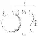 Fig. 06 - ARCHERY BOW WITH COMPONENTS HAVING A CERAMIC COATING