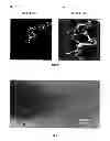 Fig. 07 - PROCESS FOR PREPARING MICRO- AND NANOCRYSTALLINE CELLULOSE