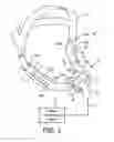 Fig. 02 - PATIENT INTERFACE DEVICE INCLUDING PRESSURE RELIEF FOR DEFORMABLE COMPENENTS