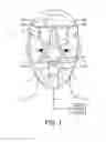 Fig. 02 - Headgear attachment mechanism for a patient interface device
