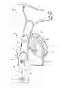 Fig. 01 - PATIENT INTERFACE WITH AN ADJUSTABLE CUSHION