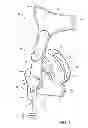 Fig. 02 - PATIENT INTERFACE WITH AN ADJUSTABLE CUSHION