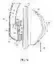 Fig. 33 - PATIENT INTERFACE WITH AN ADJUSTABLE CUSHION