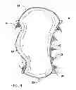 Fig. 03 - INFLATABLE MULTILEVEL VAGINAL PESSARY DEVICE